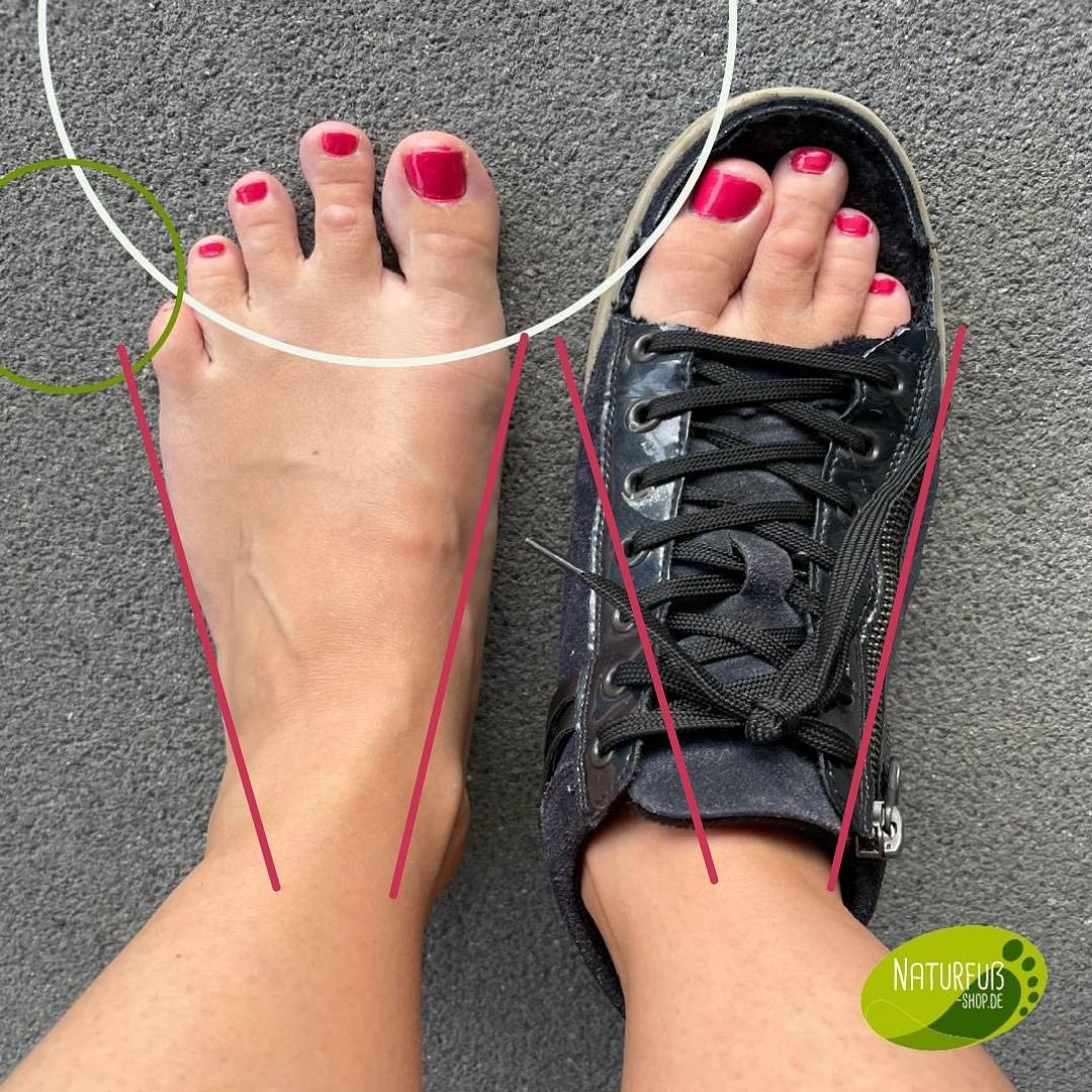 Bild Barfuß versus konventioneller Schuh aufgeschnitten